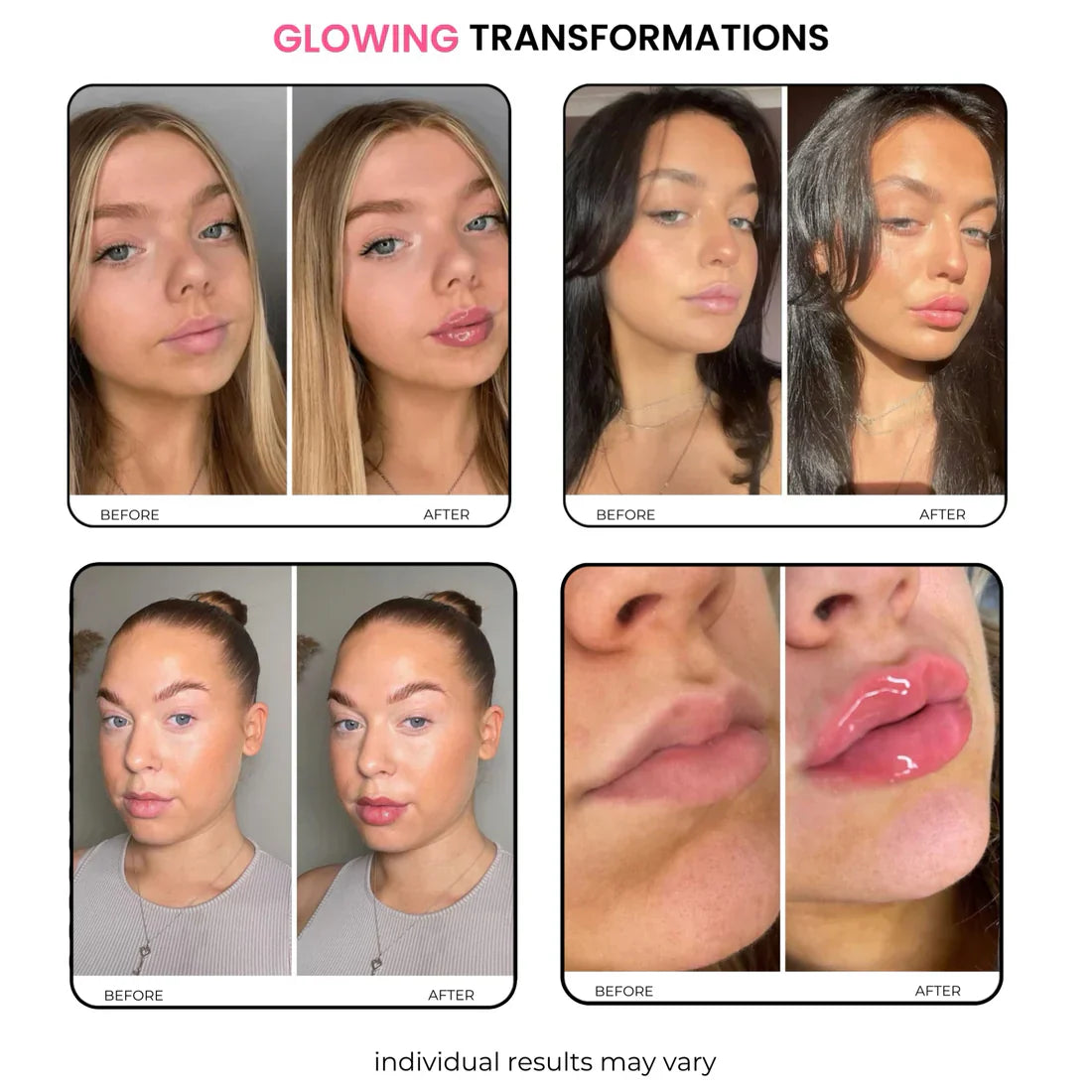 Lip Plumper 10ml